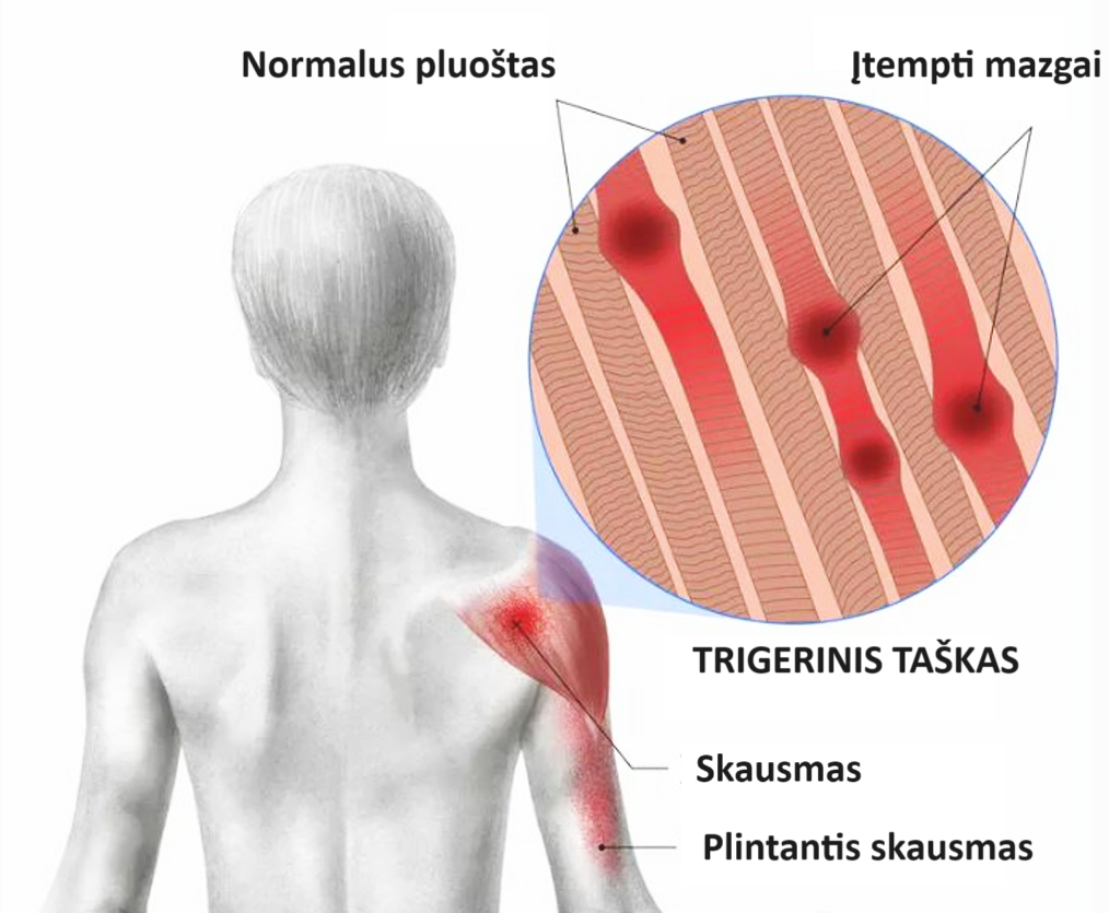 trigerinis taskas